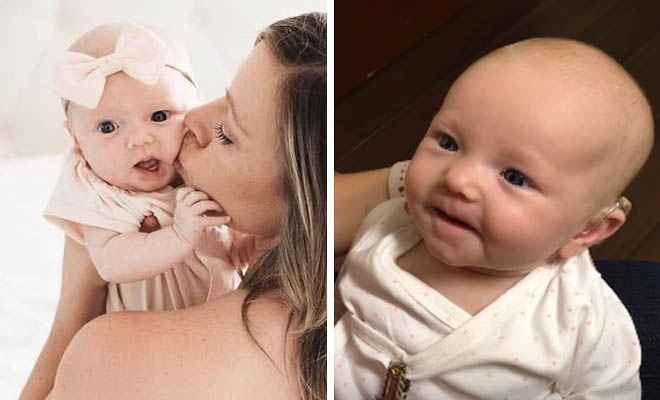 Κωφό μωρό ακούει την λέξη μαμά για πρώτη φορά με την βοήθεια ακουστικών – Θα ανατριχιάσετε
