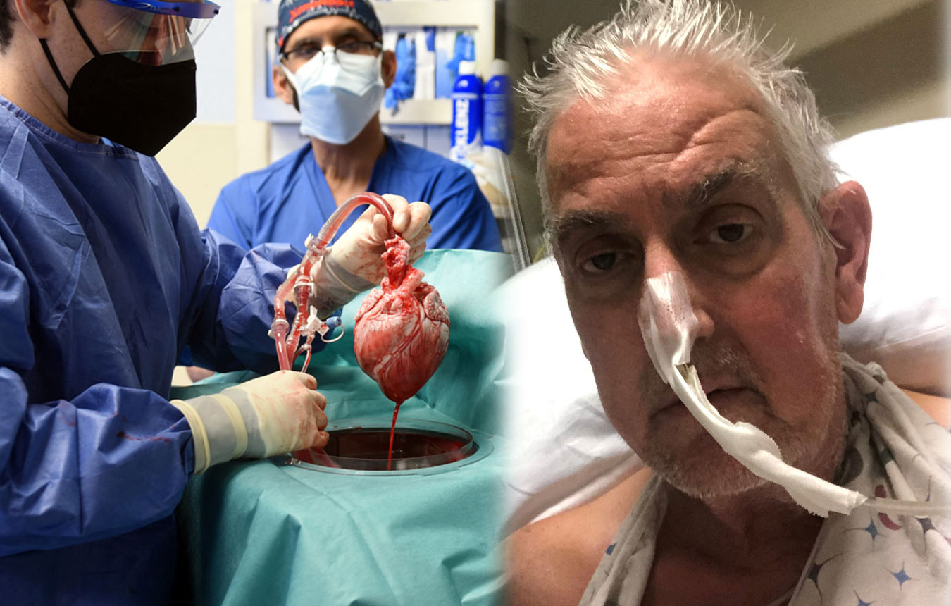 Μεταμόσχευση καρδιάς για πρώτη φορά από χοίρο σε άνθρωπο